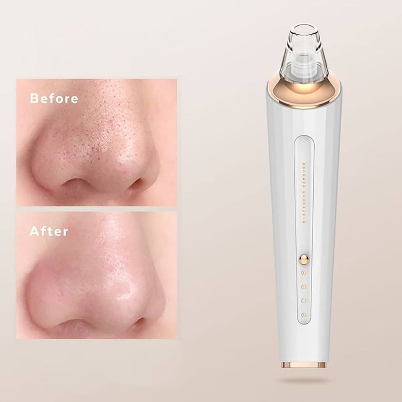 Rechargeable Blackheads Remover